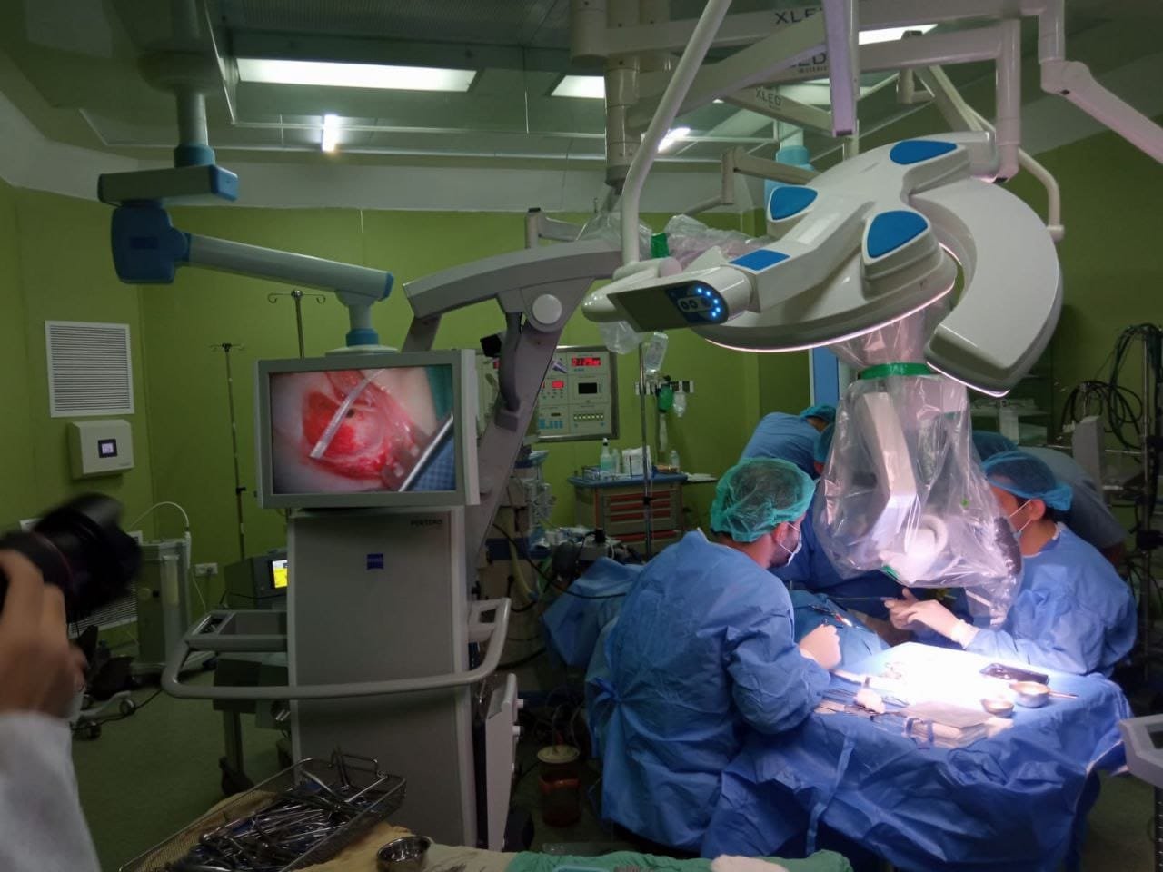 زراعة قوقعة